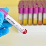 Legionella: Danger detected – danger averted